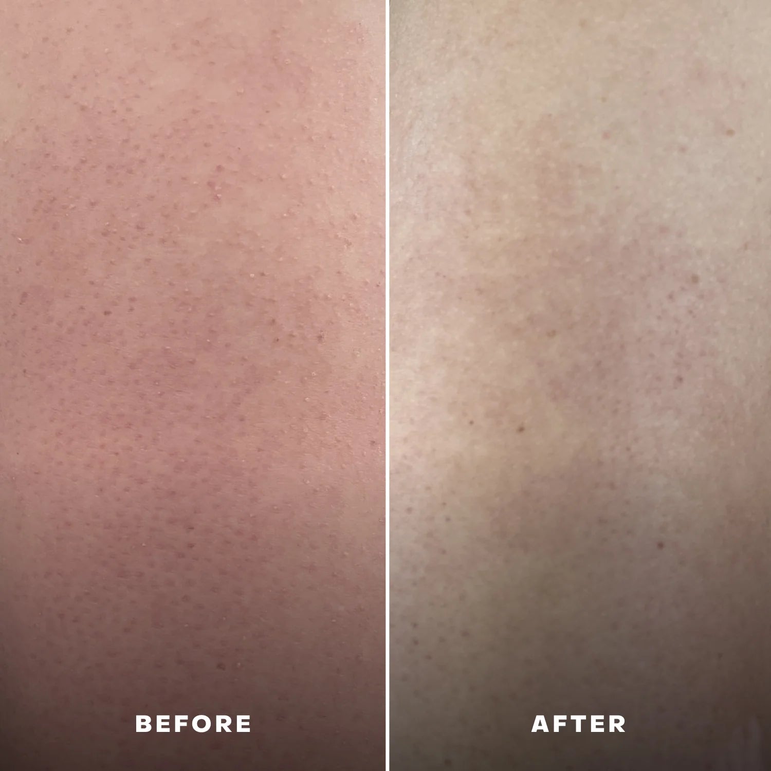 Everist Body Wash - The Exfoliating Body Wash Concentrate Tube