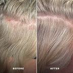 Everist Scalp Serum - Everboost for Dry & Brittle & Thinning Hair