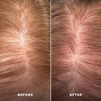 Everist Scalp Serum - Everboost for Dry & Brittle & Thinning Hair