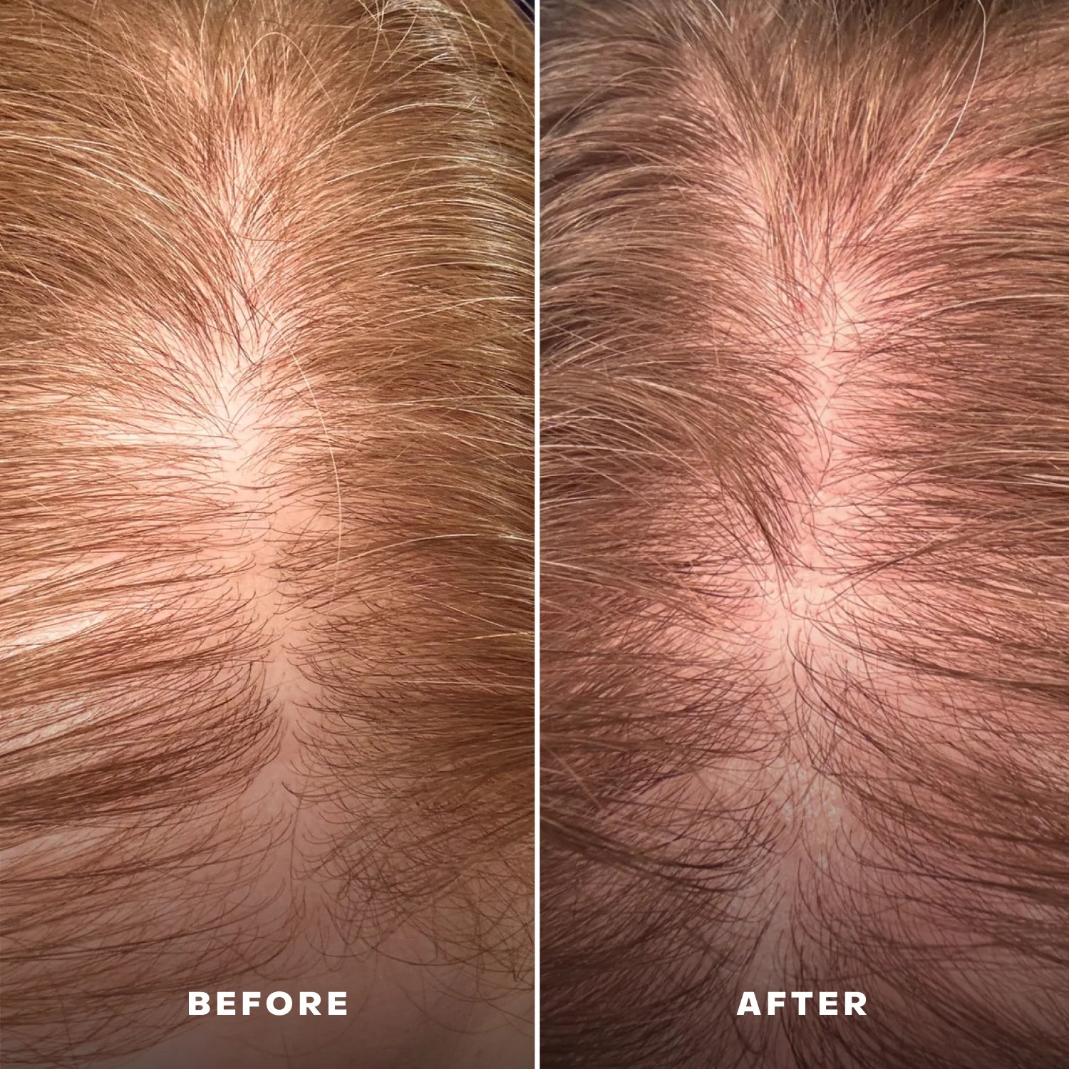 Everist Scalp Serum - Everboost for Dry & Brittle & Thinning Hair