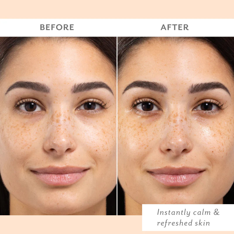 Skin Remedy Calm & Protect Mist