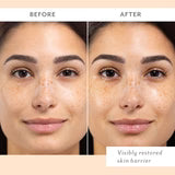 Patchology - Skin Remedy Barrier Boosting Sheet Mask