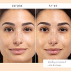 Patchology - Skin Remedy Barrier Boosting Sheet Mask